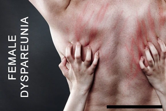 Hypoactive Sexual Desire Disorder information